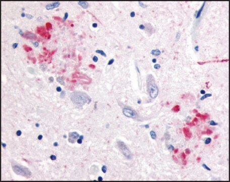 Anti-APP antibody produced in rabbit affinity isolated antibody, buffered aqueous solution