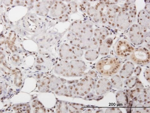 Anti-DKC1 antibody produced in mouse purified immunoglobulin, buffered aqueous solution