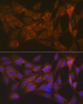 Anti-CLEC3B/Tetranectin antibody produced in rabbit