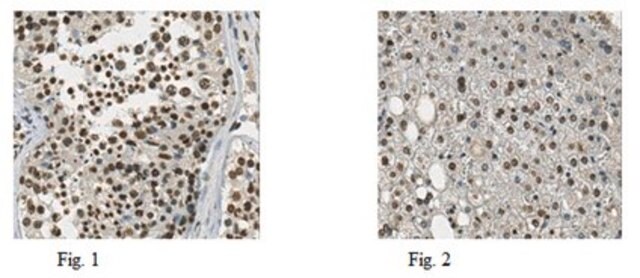 Anti-JMJD2D Antibody from rabbit, purified by affinity chromatography