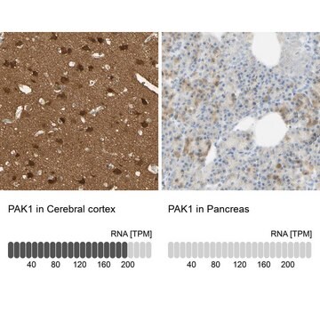 抗PAK1抗体 ウサギ宿主抗体 Prestige Antibodies&#174; Powered by Atlas Antibodies, affinity isolated antibody, buffered aqueous glycerol solution