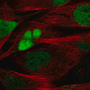 Anti-SOX8 antibody produced in rabbit affinity isolated antibody