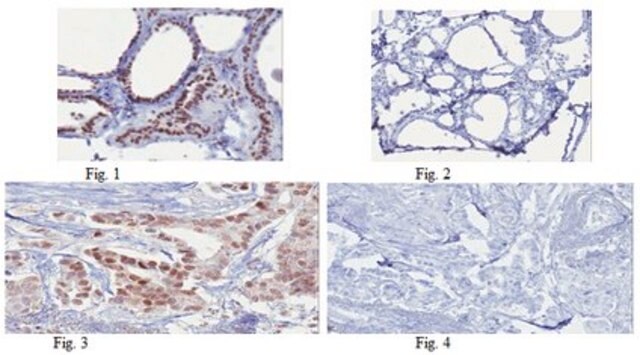 Anti-FOXO3a/FKHRL1 Antibody, clone 15F7.2 clone 15F7.2, from mouse