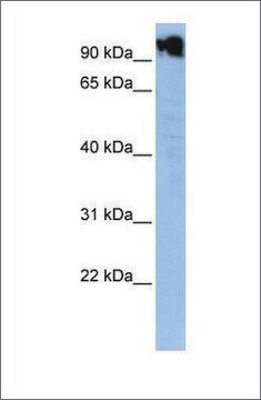 抗ZFY抗体 ウサギ宿主抗体 affinity isolated antibody