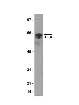 Anti-Citrulline Antibody Upstate&#174;, from rabbit