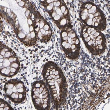 Anti-P2RY11 antibody produced in rabbit Prestige Antibodies&#174; Powered by Atlas Antibodies, affinity isolated antibody, buffered aqueous glycerol solution