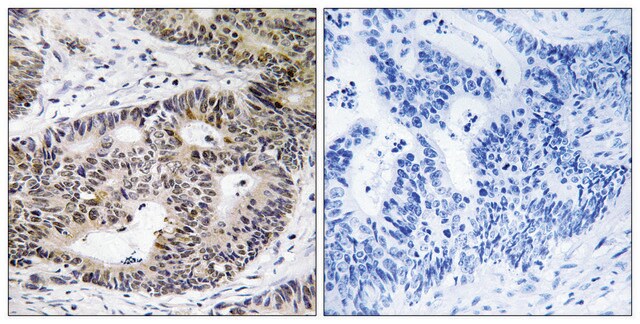 Anti-ZFYVE19 antibody produced in rabbit affinity isolated antibody