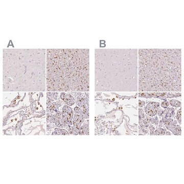 Anti-MRC1 antibody produced in rabbit Prestige Antibodies&#174; Powered by Atlas Antibodies, affinity isolated antibody, buffered aqueous glycerol solution