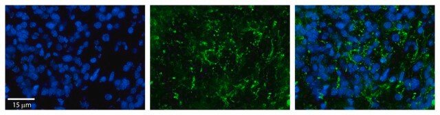 Anti-ZDHHC17 (AB1) antibody produced in rabbit affinity isolated antibody