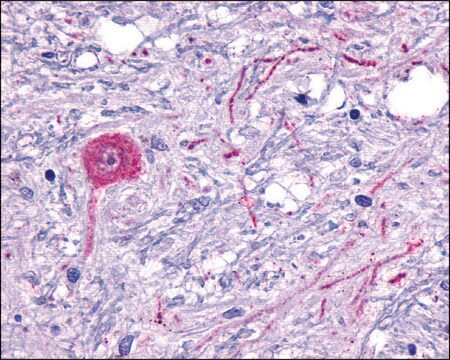 Anti-HTR6/5-HT36 antibody produced in rabbit affinity isolated antibody