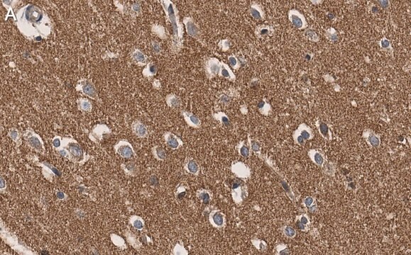 Anti-RhoB Antibody, clone 3M19 ZooMAb&#174; Rabbit Monoclonal recombinant, expressed in HEK 293 cells