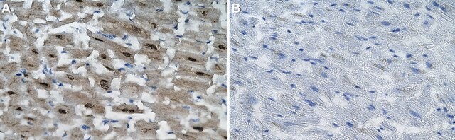 Anti-CAM kinase II Delta Antibody, clone 1E22 ZooMAb&#174; Rabbit Monoclonal recombinant, expressed in HEK 293 cells