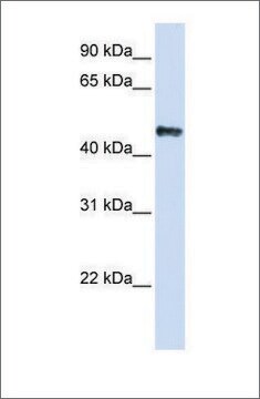 抗CSDA抗体 ウサギ宿主抗体 affinity isolated antibody