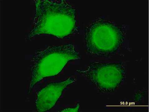 抗GAPDH抗体 マウス宿主抗体 purified immunoglobulin, buffered aqueous solution