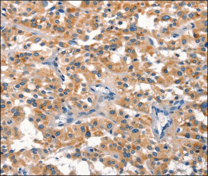 Anti-DUSP2 antibody produced in rabbit affinity isolated antibody