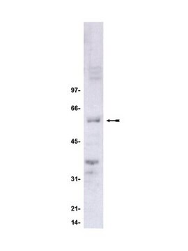 Anti-Cdc25C Antibody, clone TC-15 clone TC-15, Upstate&#174;, from mouse