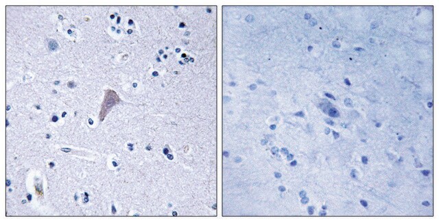 Anti-MTOR antibody produced in rabbit affinity isolated antibody