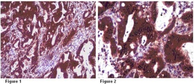 Anti-INF2-Antikörper from rabbit, purified by affinity chromatography