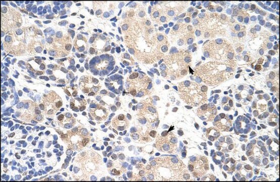 Anti-TARDBP (AB1) antibody produced in rabbit IgG fraction of antiserum