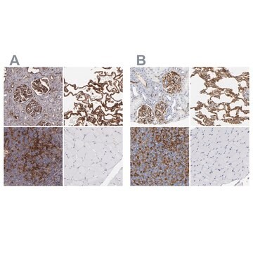 Anti-ICAM1 antibody produced in rabbit Prestige Antibodies&#174; Powered by Atlas Antibodies, affinity isolated antibody, buffered aqueous glycerol solution