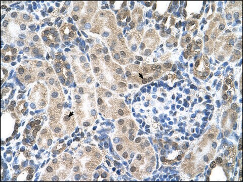 Anti-SLC19A1 antibody produced in rabbit IgG fraction of antiserum