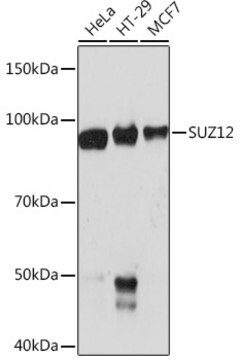 Anti-SUZ12 Antibody, clone 1M3V2, Rabbit Monoclonal