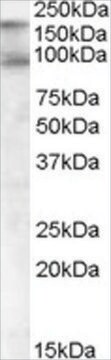 Anti-CDCP1 (Isoform 1), C-Terminal antibody produced in goat affinity isolated antibody, buffered aqueous solution