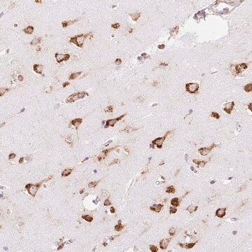 Anti-RPS17 antibody produced in rabbit Prestige Antibodies&#174; Powered by Atlas Antibodies, affinity isolated antibody, buffered aqueous glycerol solution