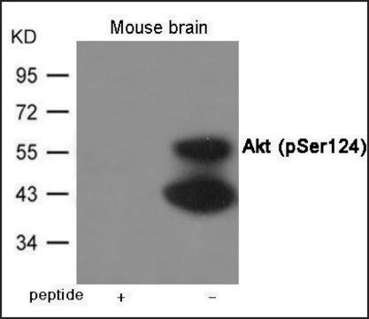 抗 磷酸化 Akt (pSer 124 ) 兔抗 affinity isolated antibody