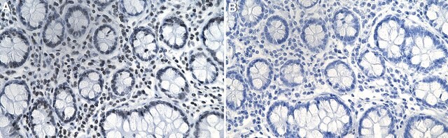 Anti-Histone H3.2 Antibody, clone 1K5-L1 ZooMAb&#174; Rabbit Monoclonal recombinant, expressed in HEK 293 cells