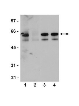 Przeciwciało anty-fosfo-Src (Tyr416), klon 2N8, królicze monoklonalne clone 2N8, Upstate&#174;, from rabbit