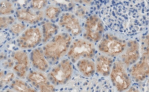 Anti-SLC5A2 Antibody, clone 2I4 ZooMAb&#174; Rabbit Monoclonal recombinant, expressed in HEK 293 cells