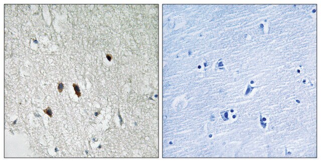 Anti-RIPK2 antibody produced in rabbit affinity isolated antibody