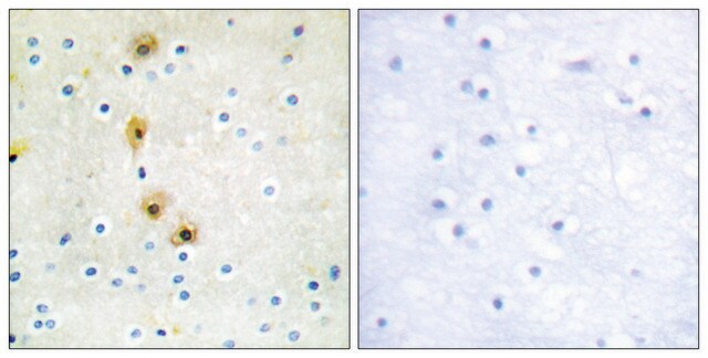 Anti-AKT antibody produced in rabbit affinity isolated antibody