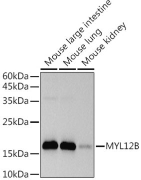 Anti-MYL12B Antibody, clone 1X3F1, Rabbit Monoclonal