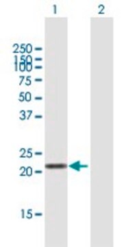 Anti-LVRN antibody produced in mouse purified immunoglobulin, buffered aqueous solution