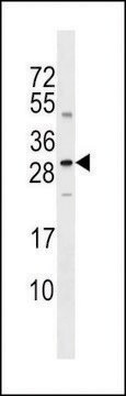 ANTI-SOST(N-TERMINAL) antibody produced in rabbit affinity isolated antibody, buffered aqueous solution