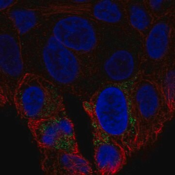 Anti-UCP2 antibody produced in rabbit Prestige Antibodies&#174; Powered by Atlas Antibodies, affinity isolated antibody