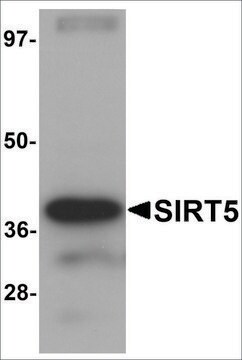 抗SIRT5抗体 ニワトリ宿主抗体 affinity isolated antibody, buffered aqueous solution