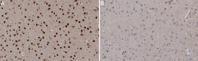 Anticorpo anti-Tbr2 from chicken, purified by affinity chromatography