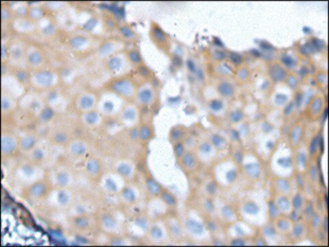 Anti-NF1 affinity isolated antibody