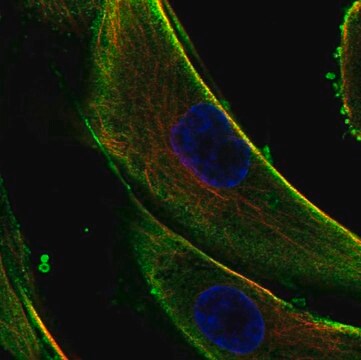 Anti-Col5A3 Antibody Produced In Rabbit Prestige Antibodies&#174; Powered by Atlas Antibodies, affinity isolated antibody, buffered aqueous glycerol solution