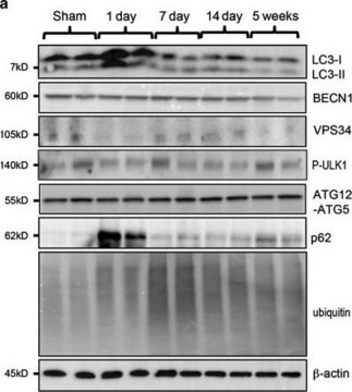 Anti-VPS34 antibody produced in rabbit ~1.0&#160;mg/mL, affinity isolated antibody, buffered aqueous solution