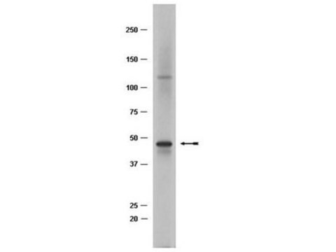 Anti-TAL-1 Antibody, clone BTL73 clone BTL73, Upstate&#174;, from mouse