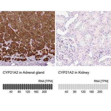 Anti-CYP21A2 antibody produced in rabbit Prestige Antibodies&#174; Powered by Atlas Antibodies, affinity isolated antibody, buffered aqueous glycerol solution