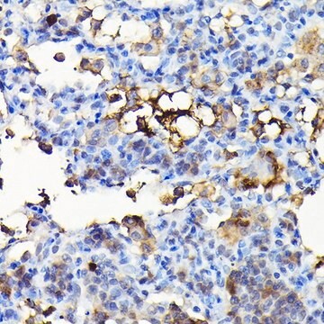 Anti- NOX4 antibody produced in rabbit