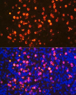 Anti-Proteinase 3/PR3 Antibody, clone 3I3M1, Rabbit Monoclonal