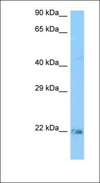 抗KRAS抗体 ウサギ宿主抗体 affinity isolated antibody