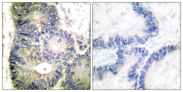 Anti-Cytochrome c antibody produced in rabbit affinity isolated antibody