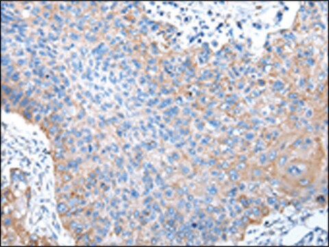 Anti-PTGIR affinity isolated antibody